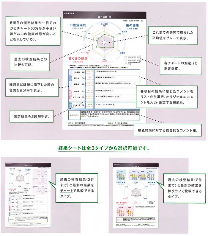 SMTで測定できる6項目