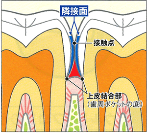 隣接面断面