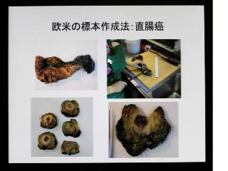 欧米の標本作成法。