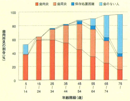 高い歯周病有病率、特に若年層が問題