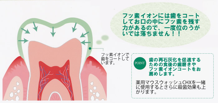 歯の再石灰化を促進するための食後の歯磨きやフッ素イオンコートをお薦めします