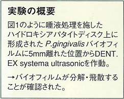 電動歯ブラシ