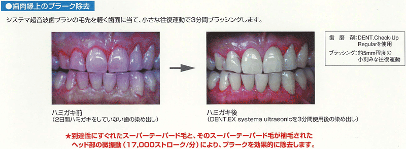 電動歯ブラシ