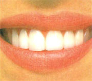 高速振動が奥歯の裏の汚れまではがし落す。
