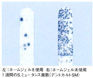 歯質の強化