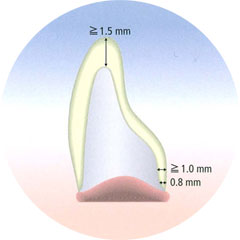 CEREC Blocs Preparatio