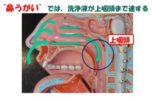 鼻うがいでは洗浄液が上咽頭まで達する