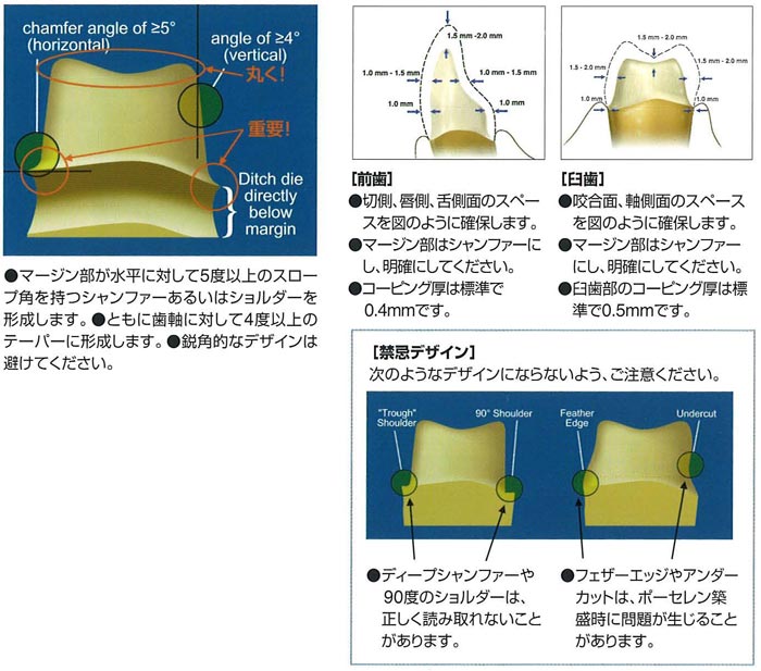 Lava TM Crowns and Bridges