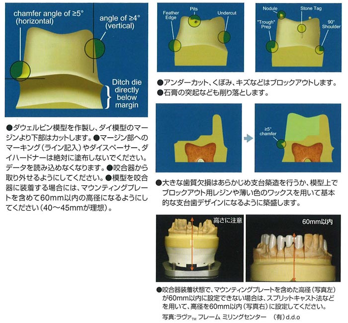 Lava TM Crowns and Bridges