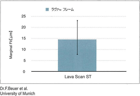 Lava TM Crowns and Bridges