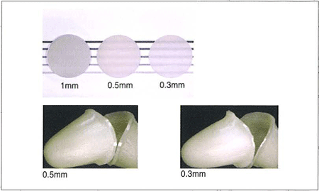 Lava TM Crowns and Bridges