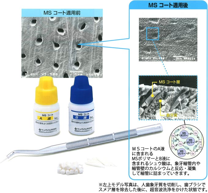 市販 薬 過敏 知覚