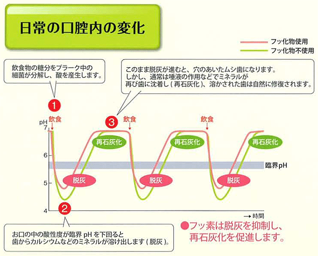 そもそも、なぜむし歯はできるの？