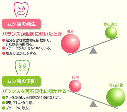 そもそも、なぜむし歯はできるの？