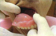 図3：リプロクリーンの中に汚れた義歯を入れ、超音波洗浄機にかける。