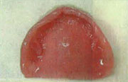 図1：強アルカリ性（ph約12）の義歯洗浄剤リプロクリーン