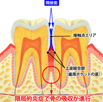 隣接面