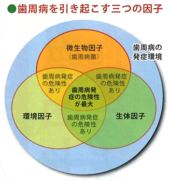 歯周病3つの因子