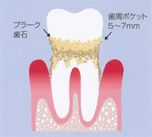 健康な状態