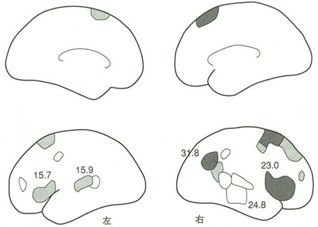 図4 音のリズム弁別時に活動する脳領域