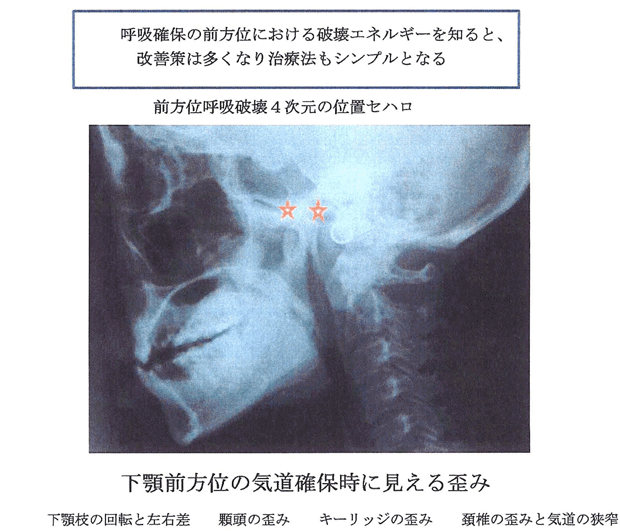 ナイトガードで改善