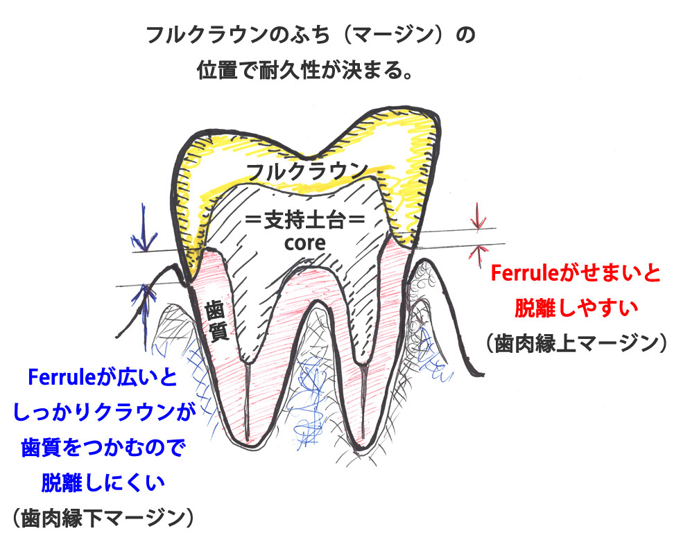 フェルール効果