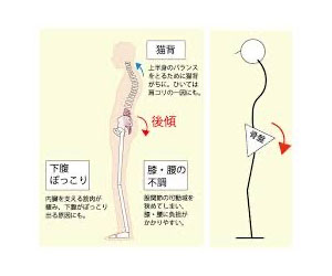 アデノイド顔貌図