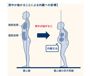 アデノイド顔貌図