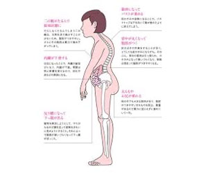 アデノイド顔貌図