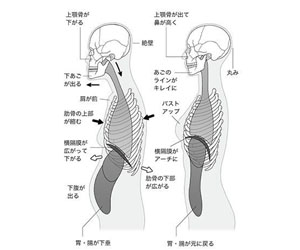 アデノイド顔貌図