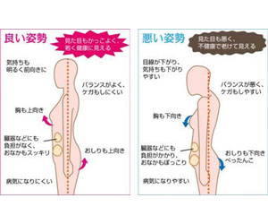 アデノイド顔貌図