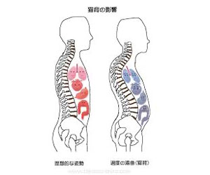 アデノイド顔貌図