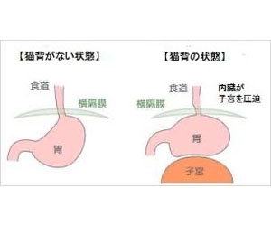 アデノイド顔貌図