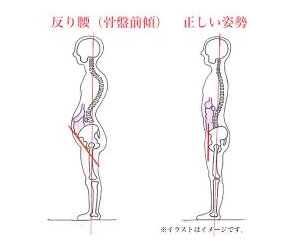 アデノイド顔貌図