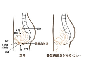 アデノイド顔貌図