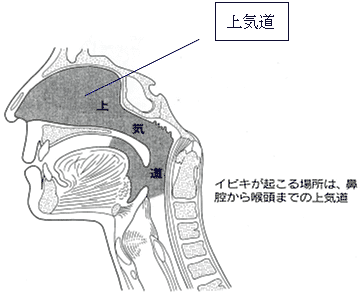 イビキや無呼吸を伴う睡眠呼吸障害