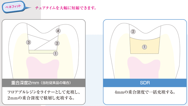 SDR　エスディーアール