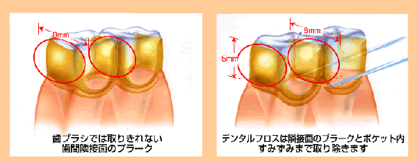 絵1隣接面