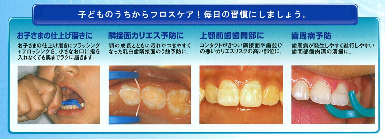 身につけよう、フロス習慣