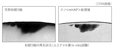 エナメル