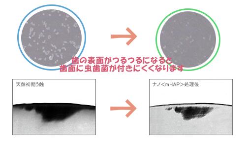 再石灰化で虫歯菌もつかない