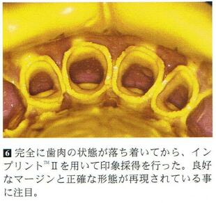 図6