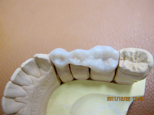クリーンな歯周組織2