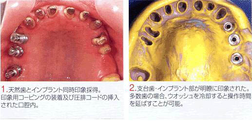 実施例